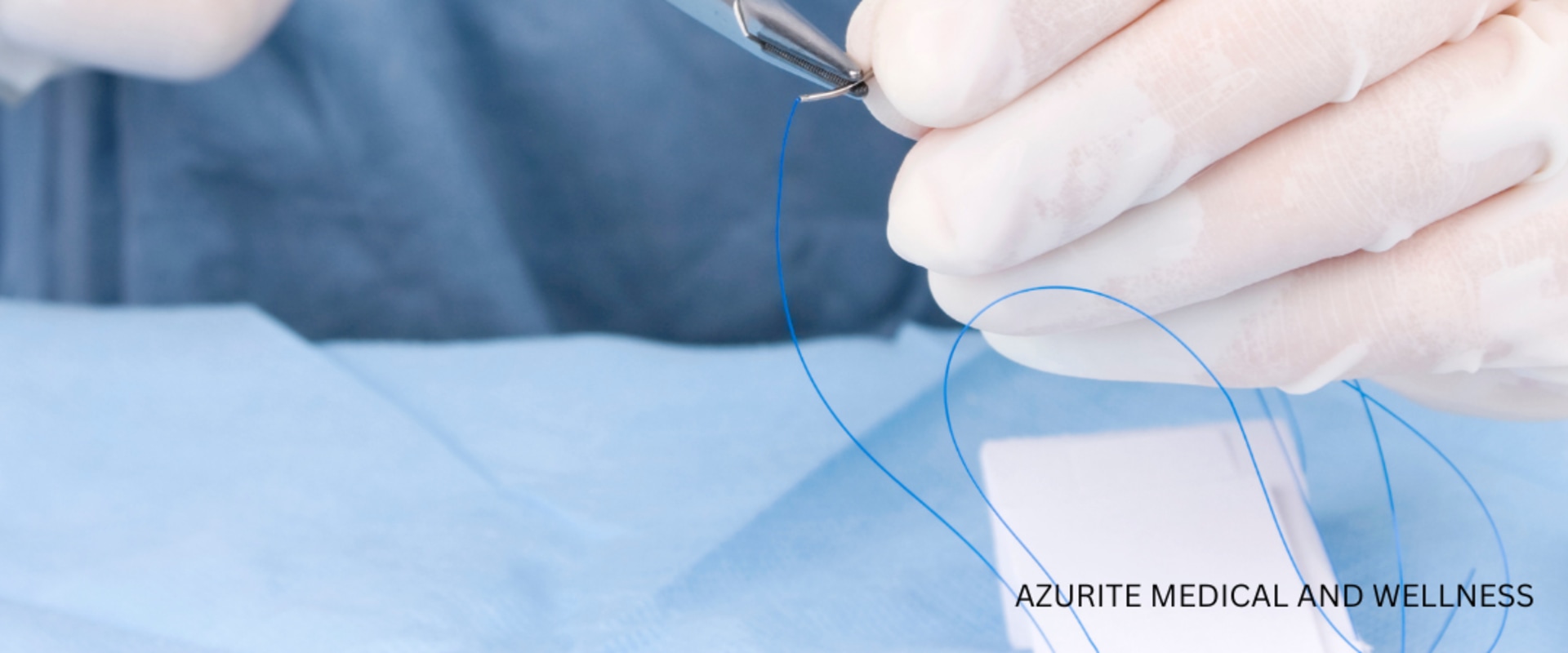 How Long Do Dissolvable Stitches Last? Complete Recovery Timeline