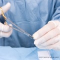 How Long Do Dissolvable Stitches Last? Complete Recovery Timeline